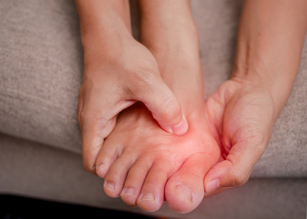 Facts About Bunions