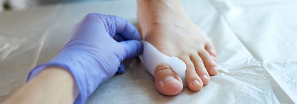 Patient Resources 5 Lapiplasty